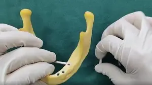 Pilar recto BLE